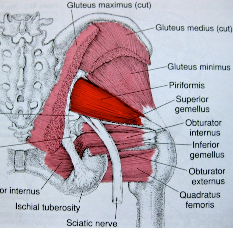 tight gluteus medius