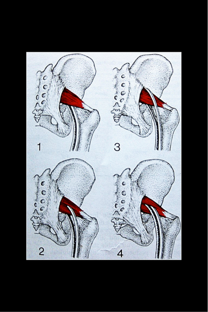 Lower Back Pain | The Hip-Flexor Fix